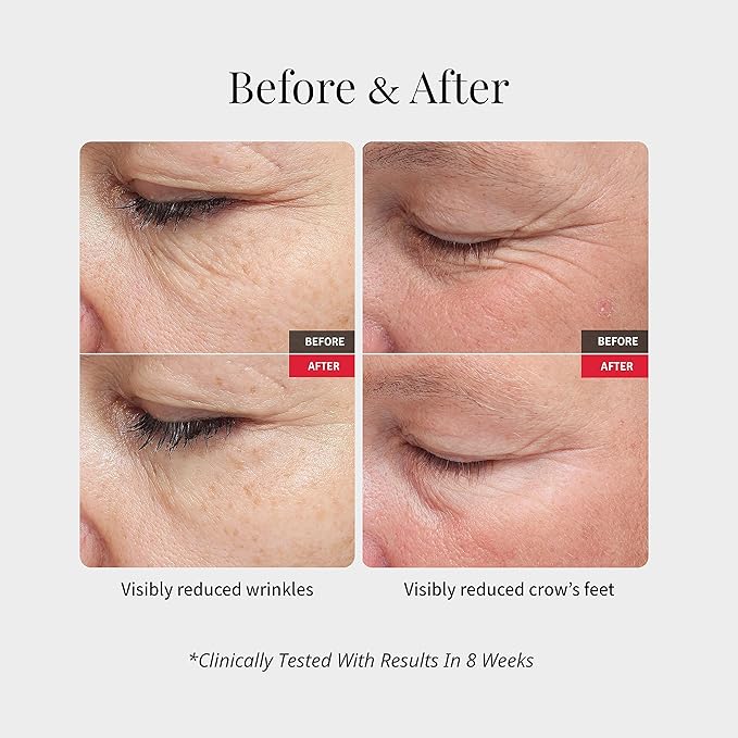 Wrinkle Serum